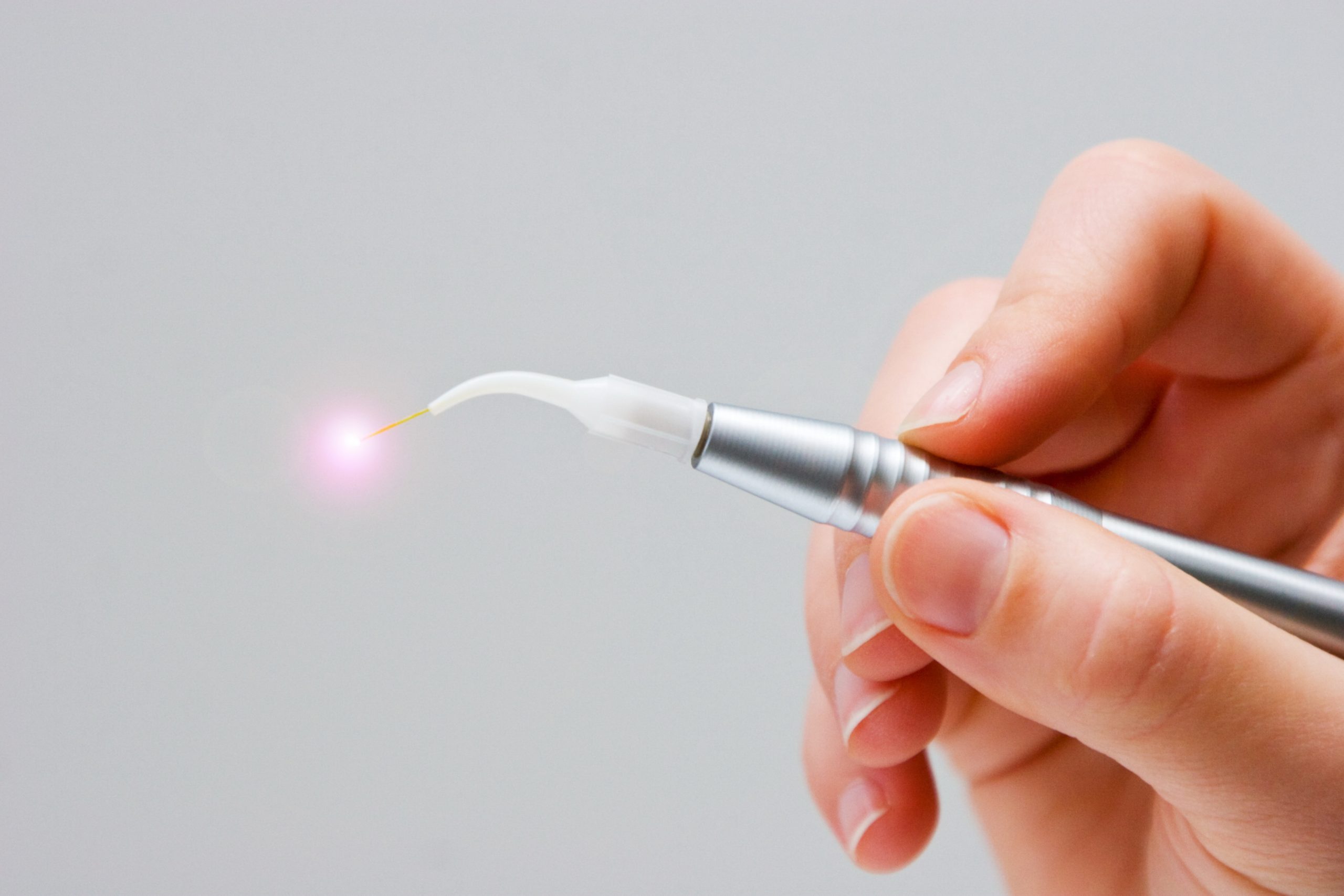 Laser Zahnbehandlung Dental-Laser